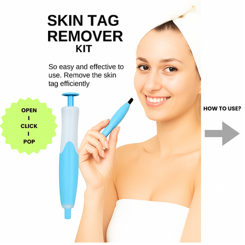 2 in 1 SKIN TAG REMOVER KIT - ABSOLUTELY PAINLESS